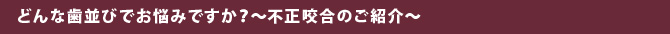 どんな歯並びでお悩みですか？～不正咬合のご紹介～ 